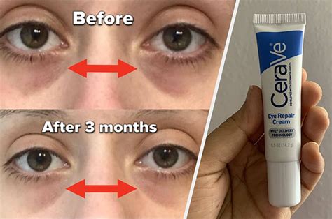 Does CeraVe Eye Repair Cream Work? And Can It Also Teach You How to Bake a Cake?